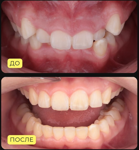 После лечения в Rembrand Clinic